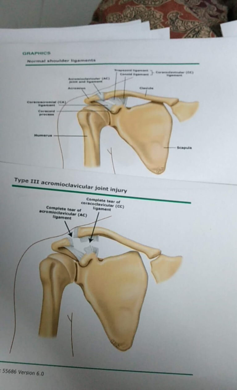 Injury
